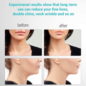 Koosette Anti Wrinkle